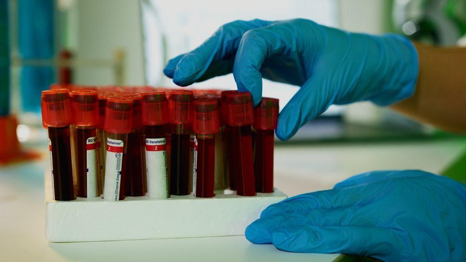 NHS offers HPV home-testing kits for women in England