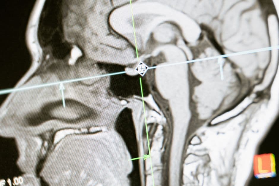 Brain Scans Prove Dogs Can Tell If You're Scared, Sad, or Happy