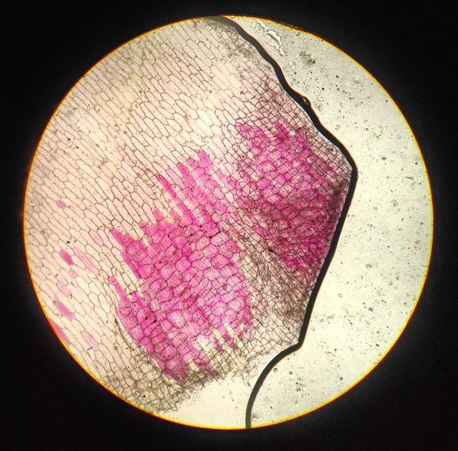 Scientists Discover Rare Brain Cells That Trigger Sleep